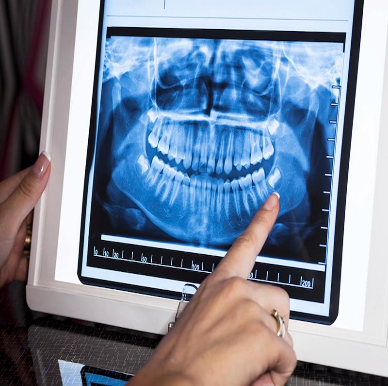 Imagen que representa a la categoría Imagenologia Odontologica