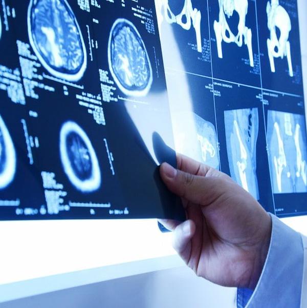 Imagen que representa a la categoría Imagenologia