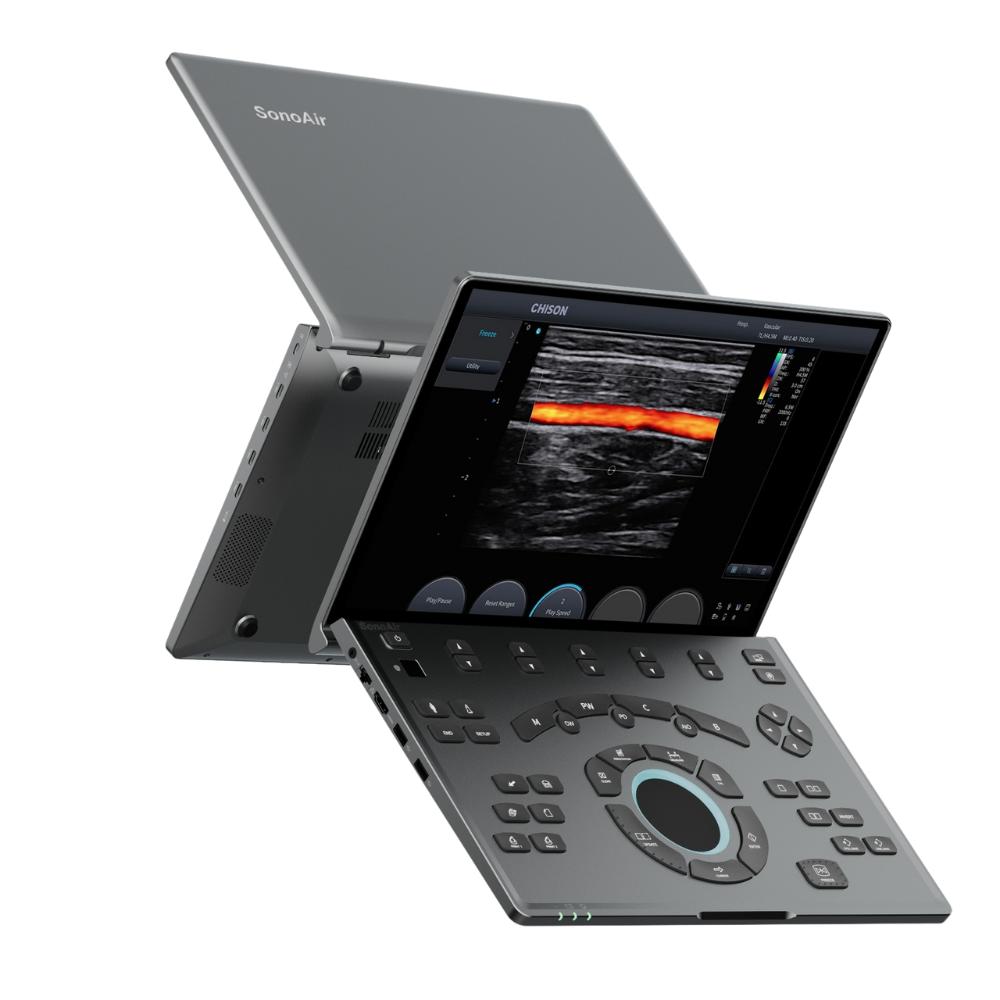 Ecógrafo Portátil CHISON SonoAir 30