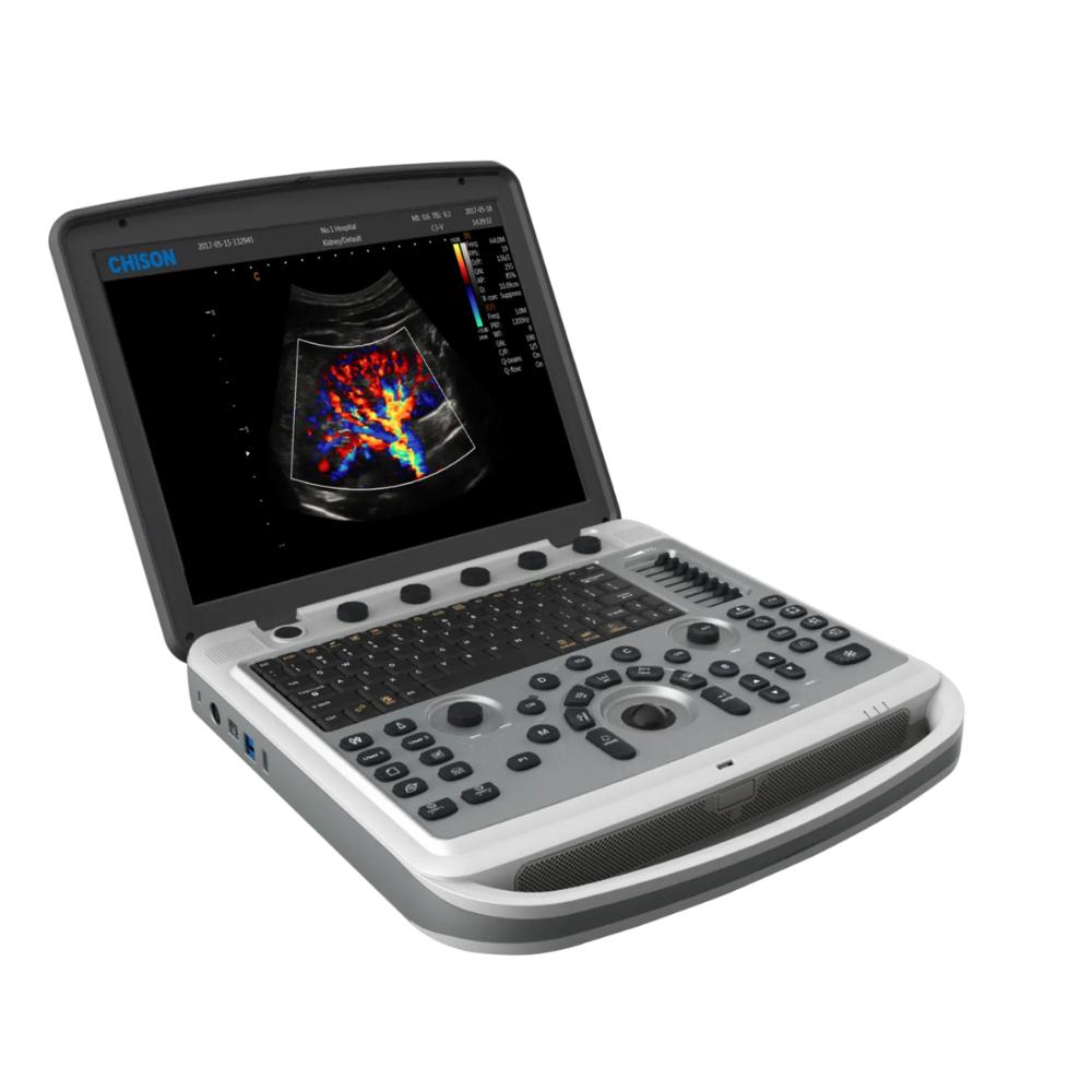 Producto ecografo-portatil-chison-sonobook-7-2