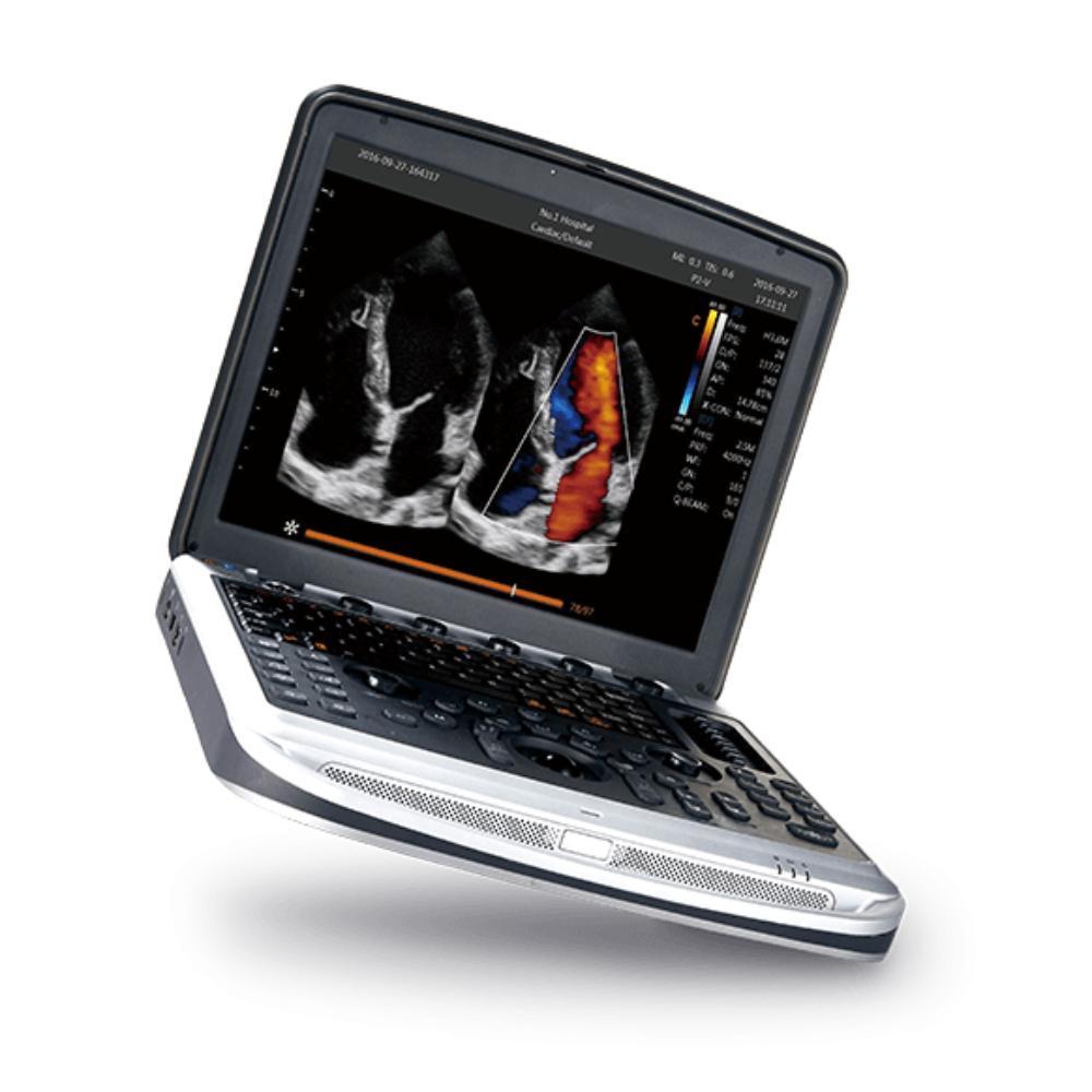 Producto ecografo-portatil-chison-sonobook-7-3