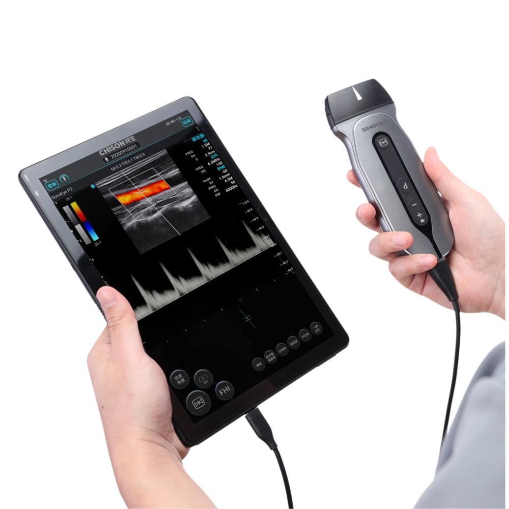 Ecógrafo Portátil CHISON SonoEye P2