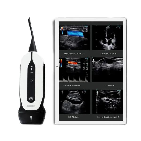 Producto ecografo-veterinario-portatil-chison-sonoeye-p2-vet-3