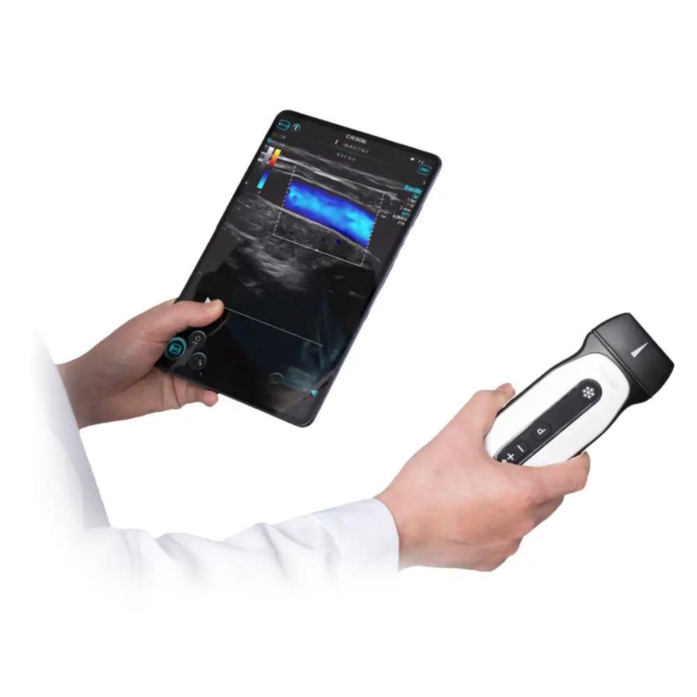 Producto ecografo-veterinario-portatil-chison-sonoeye-p2-vet-4
