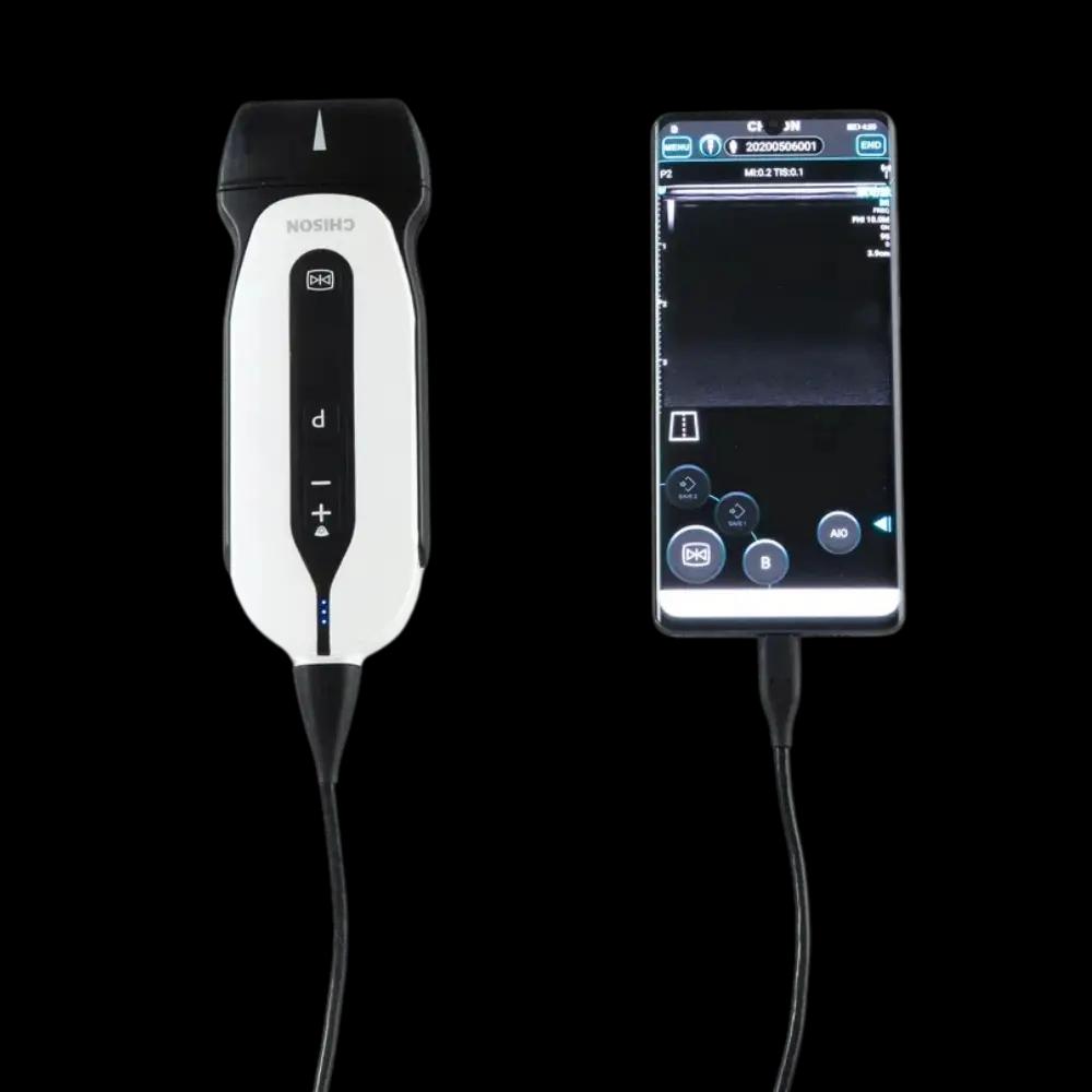 Ecógrafo Veterinario Portátil CHISON SonoEye P2 VET
