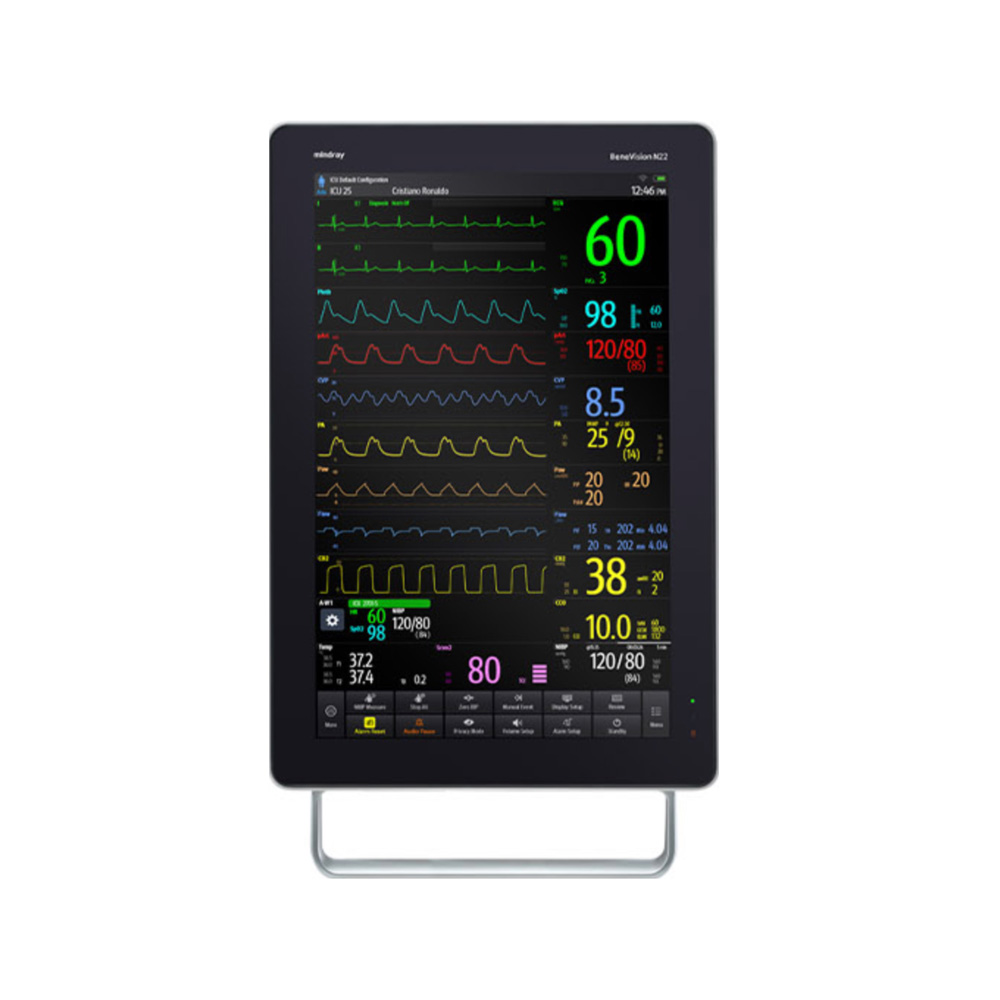 Monitor de Signos Vitales Mindray BeneVision N19/N22